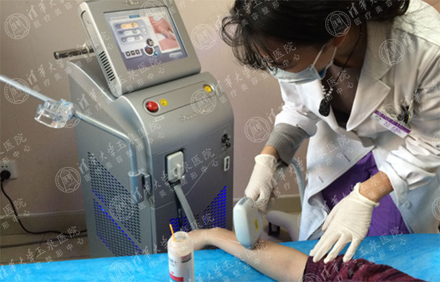 激光脱毛后的真实感受,激光脱毛一年后的真实感受