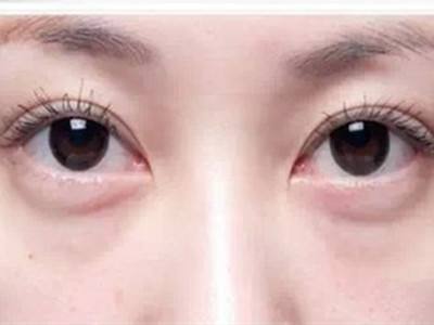 为什么眼周要用专门的眼霜,修正抗皱眼霜提亮眼周淡化黑眼圈