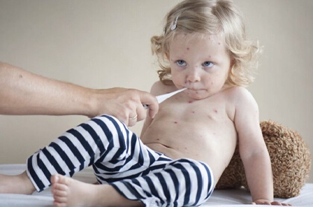 小儿水痘的中医辨证分型治疗,小儿水痘治疗方案