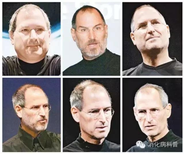 乔布斯的癌症治疗过程,史蒂夫乔布斯抗癌