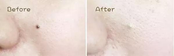 遮瑕这样用打造自然无瑕底妆,遮瑕技巧这样修饰妆容太精致了