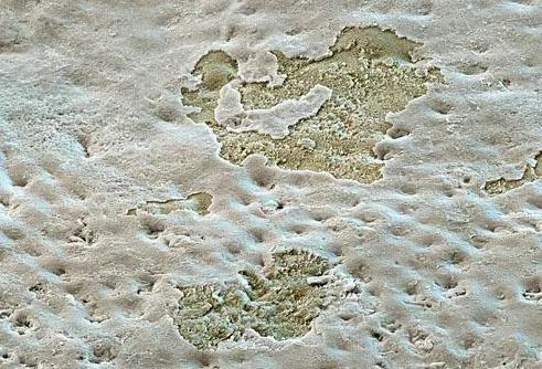 牙釉质磨损遇冷热硬都疼,牙釉质有隐裂怎么办