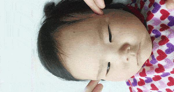 于娟教授小儿推拿治感冒,小儿推拿感冒四大手法