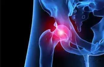 人生最后一次骨折保守治疗,髋部骨折又称人生最后一次骨折