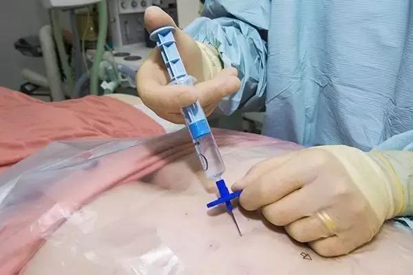 肺转移有必要再做活检穿刺吗,转移瘤有必要做穿刺活检吗