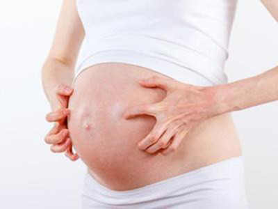 孕妇妊娠瘙痒症是什么原因,孕期妊娠纹痒怎么办