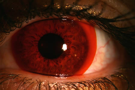 世界第一副隐形眼镜,世界上最奇怪的眼镜