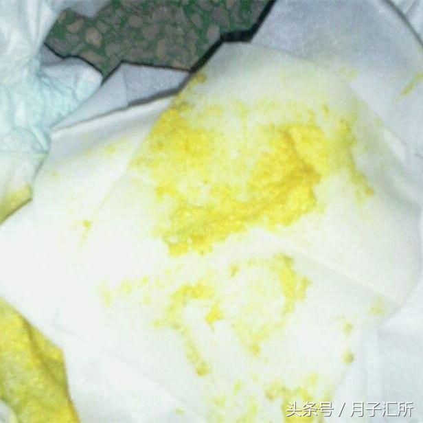宝宝便便说明健康,宝宝便便有奶瓣颗粒还是绿色的
