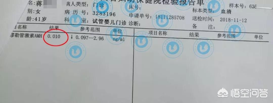 月经少是卵巢早衰老得快吗,月经量特别少是卵巢早衰吗