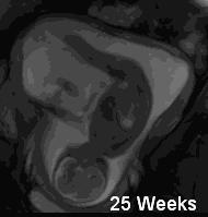 孕34周胎动在肚脐周围是什么胎位,怀孕8个月胎儿胎动真实视频