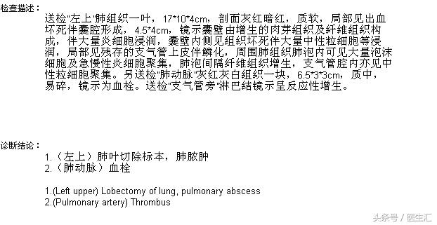 两年了老是咳嗽怎么回事,老人稍微活动气急气喘怎么办