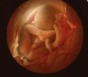 孕妇怀着双胞胎宝宝忽然羊水破了,孕妇因为无知害死孩子