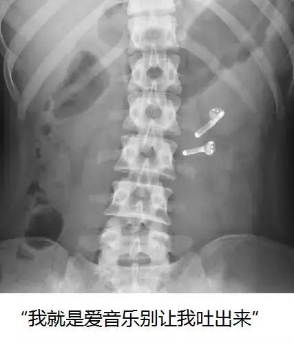 狗狗便血又臭又稀,狗狗便血吃了药还便血怎么办