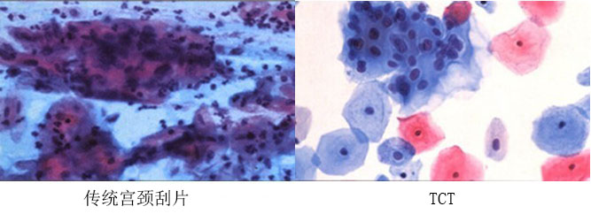 体检项目一览表女性60-70岁,女性体检科普短片