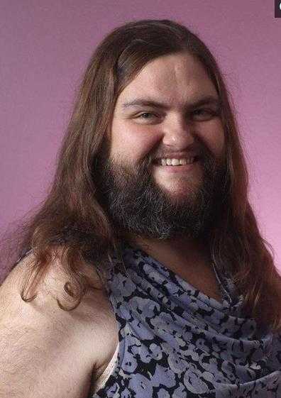 13岁女孩长满络腮胡一度不想活，直到遇见非洲男友重拾自信