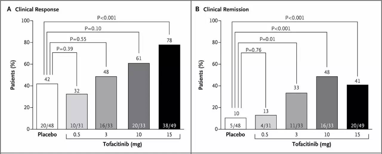 溃疡性结肠炎最新医学突破,溃疡性结肠炎重大突破最新消息