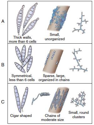 人传染了猫癣还会传染给其他人吗,得了猫癣会烂哪里