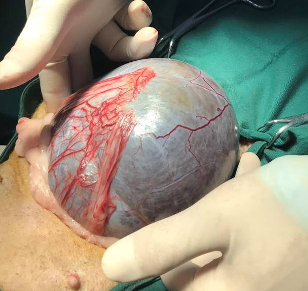 老年犬肿瘤手术现场你知道狗狗患癌症的十大症状吗？