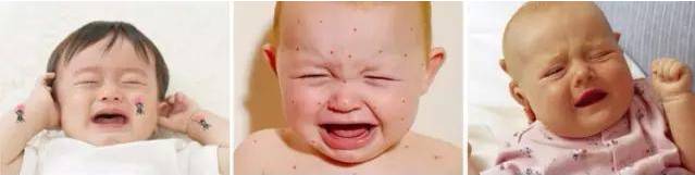 日本驱蚊液防蚊虫叮咬神器,驱蚊止痒消肿蚊虫叮咬喷雾