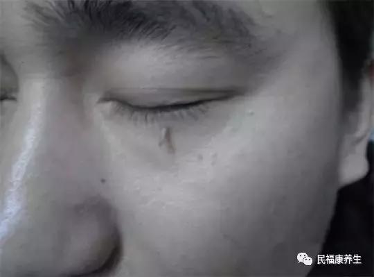 身上的肉瘊对身体有什么影响,身上肉里有疙瘩属于啥病