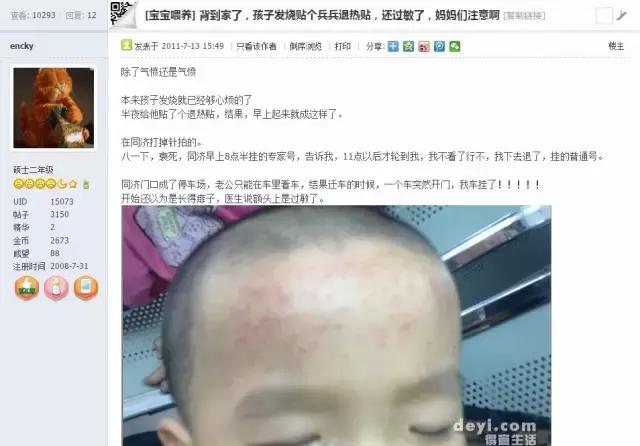 退热贴过敏发红起疹子怎么办,宝宝贴完退热贴额头起红斑怎么办