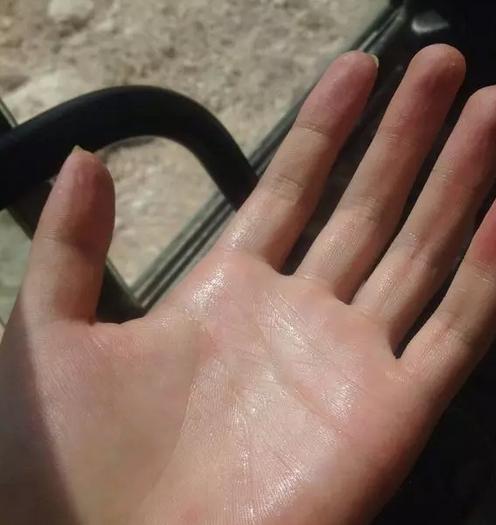 浑身发冷手心出汗是怎么回事,浑身发冷嘴唇热手心热