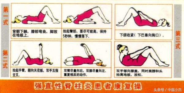 高考体检有强直性脊柱炎,孩子高考腰疼如何治疗