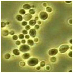 猫真菌皮肤病怎么预防,怎样预防狗真菌给人传染