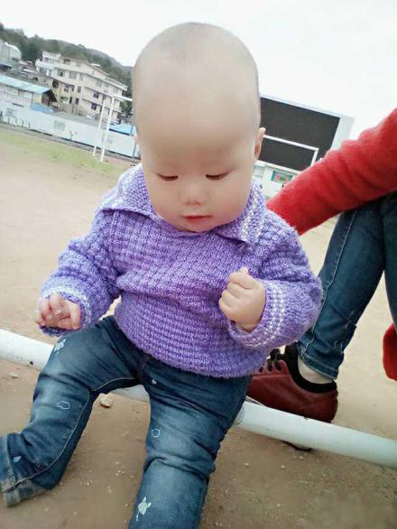 宝宝拇指内扣，可以这三种方法来纠正！