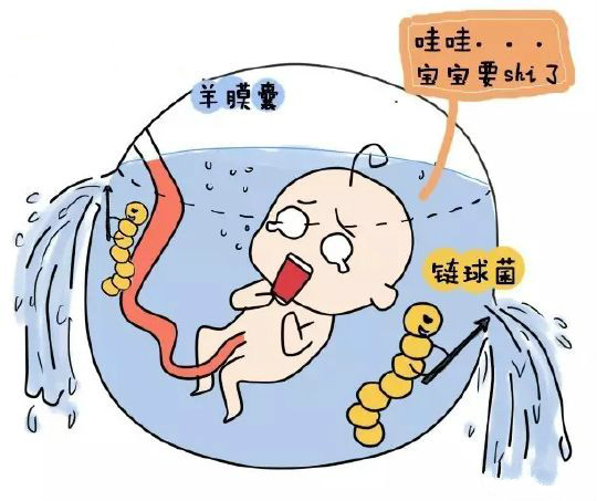 35周为什么会高位破水啊,37周高位破水流褐色分泌物