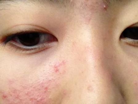 不洗脸皮肤不出那么多油了,不洗脸脸就很油