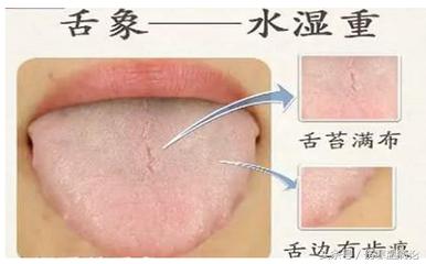 夏季吹空调感冒吃什么药效果好,夏季感冒咳嗽喉咙有痰鼻塞流鼻涕