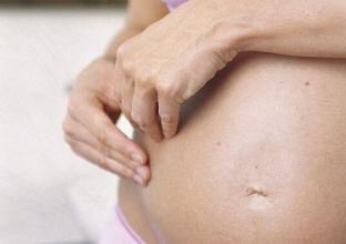 孕妈湿疹用什么外用药,孕期湿疹宝妈