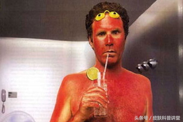 海滩玩的时间长把皮肤晒伤怎么办,皮肤晒伤但是要出门怎么保护