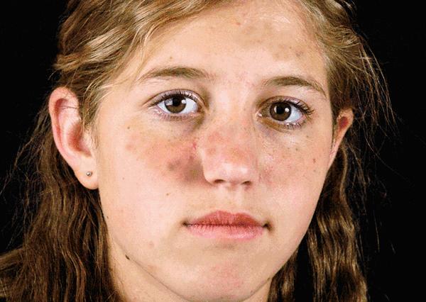 长了“*褐斑黄**”被老公嫌弃该怎么救？祛斑“神药”能随便吃吗？