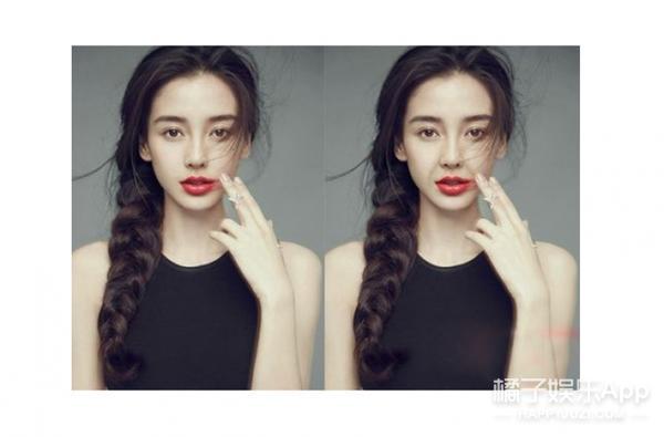 笑容引起的法令纹怎么解决,明星淡化法令纹最简单方法