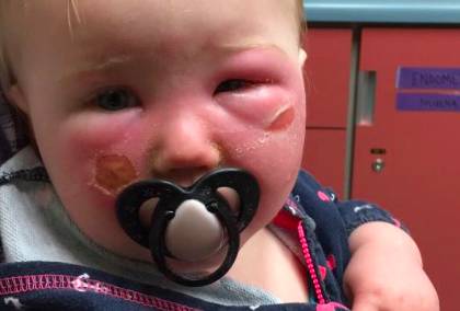 还在给宝宝海淘香蕉船防晒霜?出事了!家里有的快扔掉!