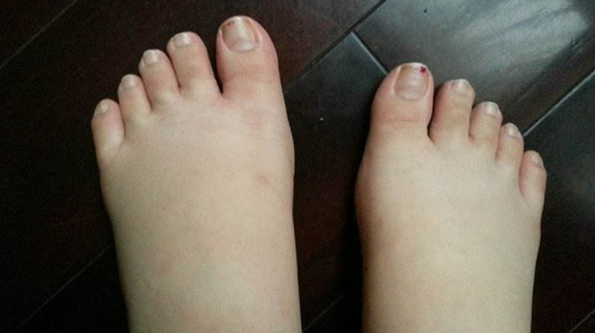 脚部瘙痒是大病的前兆,脚部出现六大症状表示大病来临