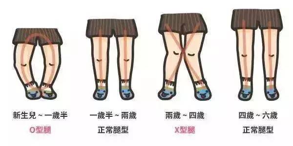 怎么坐改善驼背,宝宝怎么坐起来不伤腰