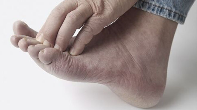 脚部瘙痒是大病的前兆,脚部出现六大症状表示大病来临