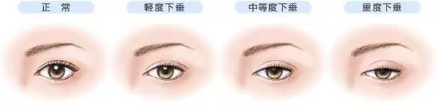 关关变身成美女,关关拿掉眼睛