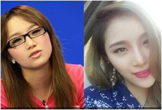 女歌手整容失败成什么样了,十位整容失败的女生
