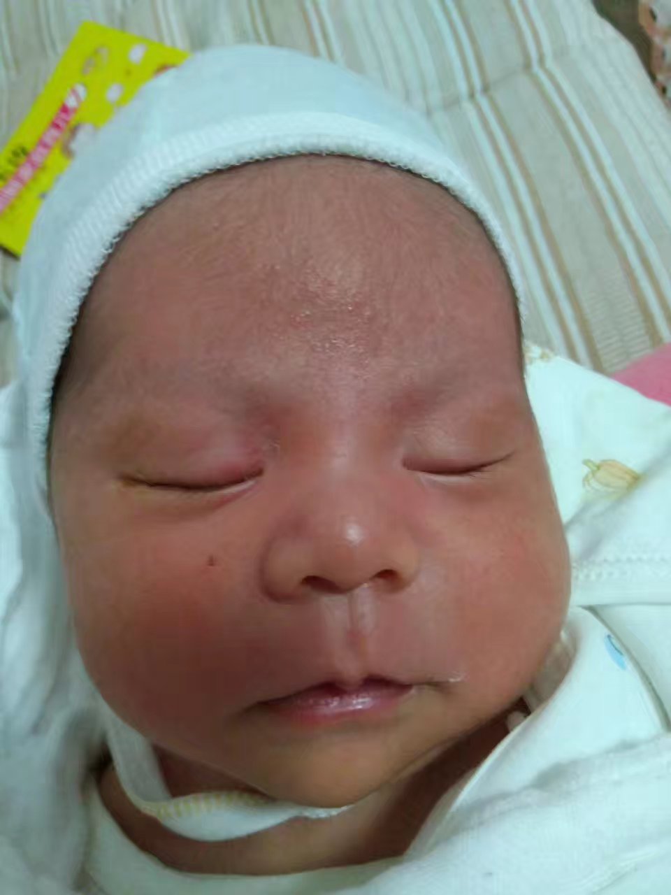 宝宝湿疹反反复复要怎样改善呢,宝宝湿疹反复发作难治愈