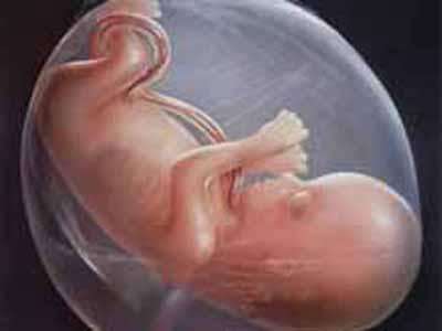 顺产还是剖腹产很纠结,不管顺产还是剖腹产坐月子别瞎忙