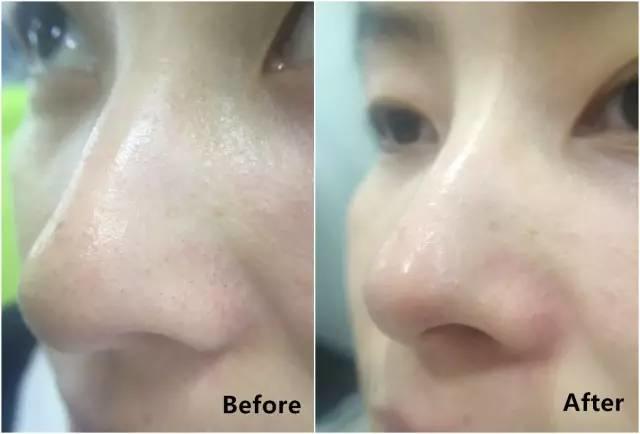 rydeen白泥清洁泥膜效果怎么样,平价好用的清洁泥膜测评