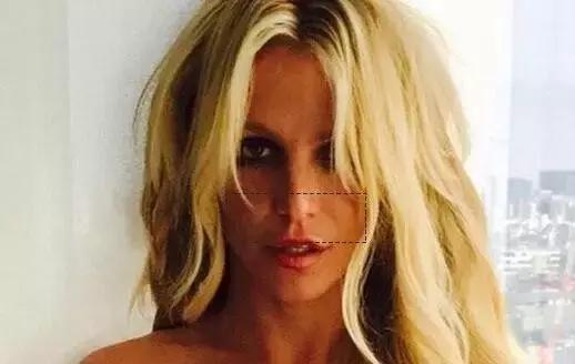 听说爱笑的女孩子法令纹都很深,爱笑的女孩真的容易得法令纹吗