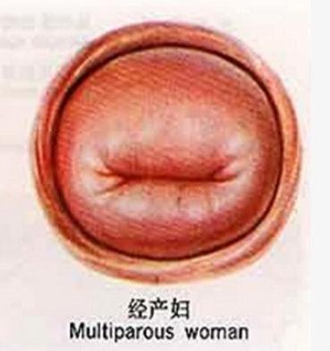 Angelababy产后素颜出席活动，身体这一部位足以看出她生过孩子，网友指责黄晓明