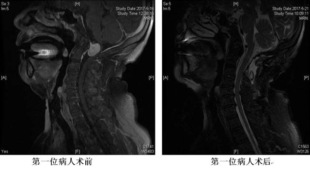 青大附院下雨时间表,青大附院下雨时间