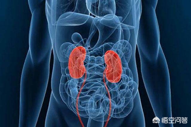 糖尿病肾病怎么查,什么叫糖尿病肾病