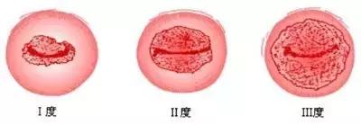 陪闺蜜看急诊,陪闺蜜看妇科顺倒长了知识